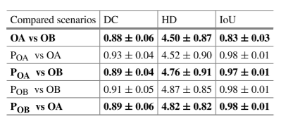 table1